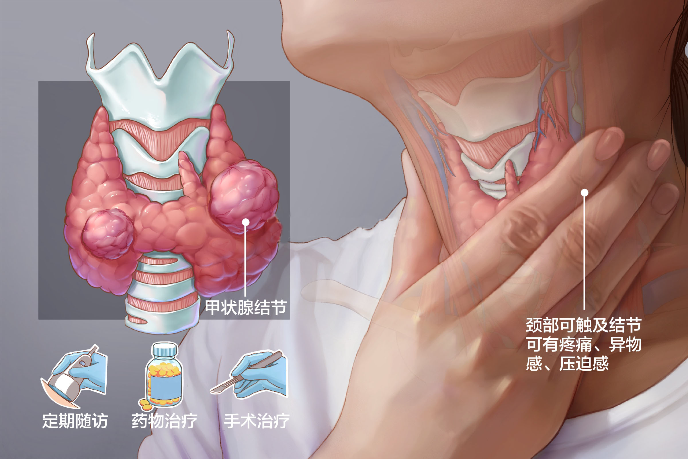 重庆甲状腺医院
