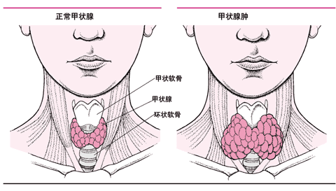 重庆甲状腺医院排名